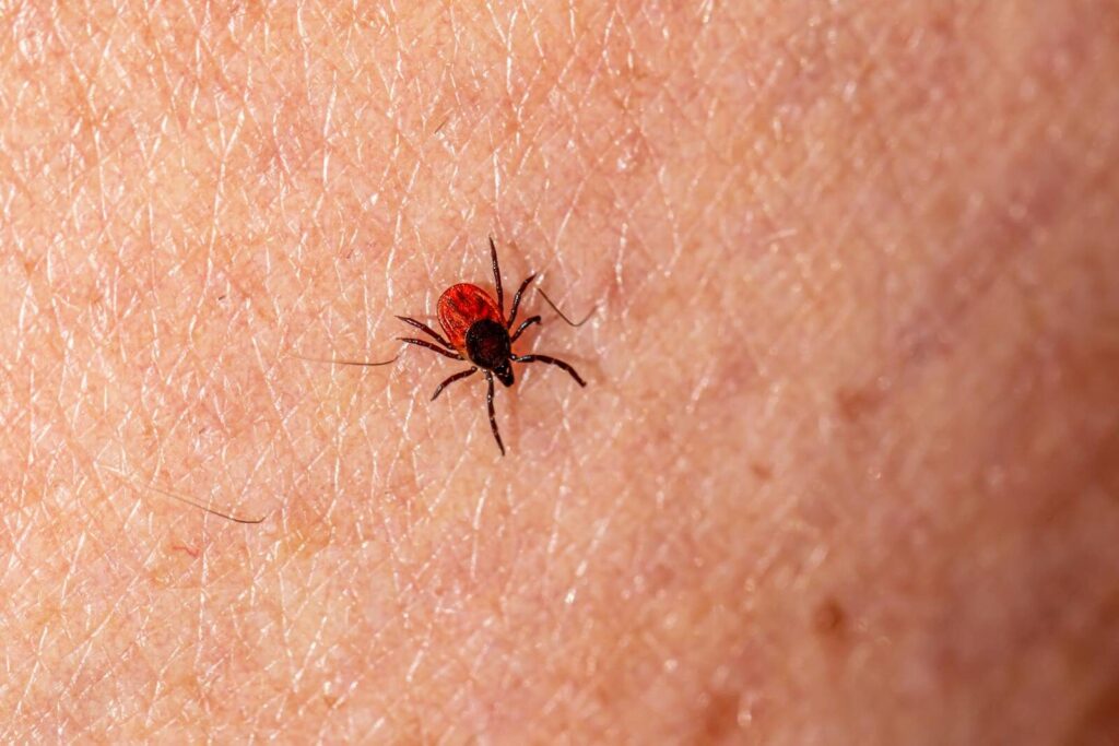 Macro photograph showing a deer tick (Ixodes scapularis) on human skin, highlighting pest detail.