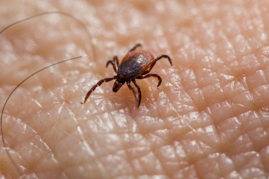 Macro image of a tick on human skin, highlighting the risk of Lyme disease.